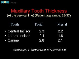 Maxillary Tooth Thickness
(At the cervical line) (Patient age range: 28-37)
•  Central Incisor 2.3 2.2
•  Lateral Incisor 2.1 1.8
•  Canine 2.8 2.1
Stambaugh, J Prosthet Dent 1977;37:537-546
Tooth Facial Mesial
 