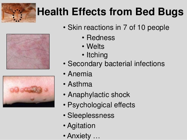 bed bug bite effects bed bug biology and research central ohio bed bug task force bed bug bite effects bed bug biology and research central ohio bed bug task force