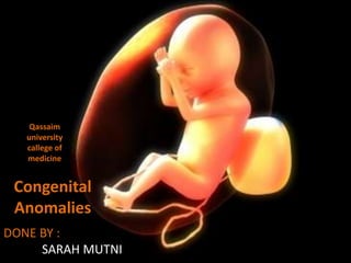 Congenital
Anomalies
DONE BY :
SARAH MUTNI
Qassaim
university
callege of
medicine
 