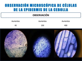 OBSERVACIÓN MICROSCÓPICA DE CÉLULAS
DE LA EPIDERMIS DE LA CEBOLLA
OBSERVACIÓN
Aumentos
40
Aumentos
100
Aumentos
400