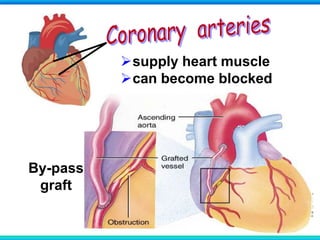 supply heart muscle
can become blocked
By-pass
graft
 