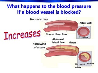What happens to the blood pressure
if a blood vessel is blocked?
Normal blood flow
Abnormal
blood flow
 