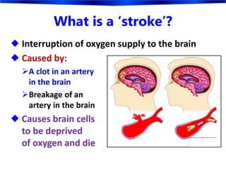 What is a ‘stroke’?
 Interruption of oxygen supply to the brain
 Caused by:
A clot in an artery
in the brain
Breakage of an
artery in the brain
 Causes brain cells
to be deprived
of oxygen and die
 