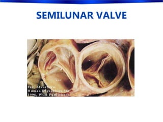 SEMILUNAR VALVE
 