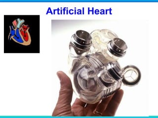 Artificial Heart
 