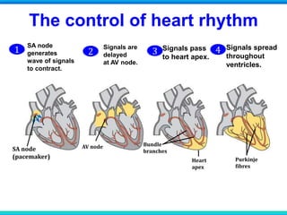 The control of heart rhythm
SA node
(pacemaker)
AV node Bundle
branches
Heart
apex
Purkinje
fibres
2
Signals are
delayed
at AV node.
1
SA node
generates
wave of signals
to contract.
Signals pass
to heart apex.
4 Signals spread
throughout
ventricles.
1 2 3 4
 