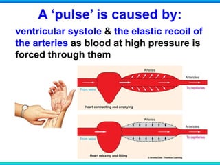A ‘pulse’ is caused by:
ventricular systole & the elastic recoil of
the arteries as blood at high pressure is
forced through them
 