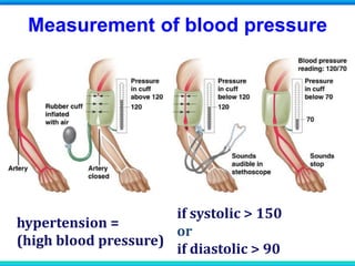 Measurement of blood pressure
hypertension =
(high blood pressure)
if systolic > 150
or
if diastolic > 90
 