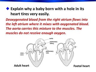  Explain why a baby born with a hole in its
heart tires very easily.
Deoxygenated blood from the right atrium flows into
the left atrium where it mixes with oxygenated blood.
The aorta carries this mixture to the muscles. The
muscles do not receive enough oxygen.
Adult heart Foetal heart
 