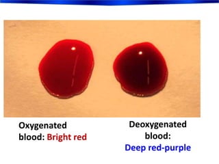 Deoxygenated
blood:
Deep red-purple
Oxygenated
blood: Bright red
 