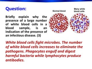 Question:
White blood cells fight microbes. The number
of white blood cells increases to eliminate the
pathogens. Phagocytes engulf and digest
harmful bacteria while lymphocytes produce
antibodies.
Briefly explain why the
presence of a large number
of white blood cells in a
blood sample, is an
indication of the presence of
an infectious disease. (3)
 