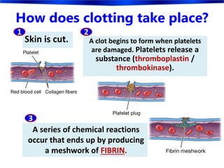 How does clotting take place?
A clot begins to form when platelets
are damaged. Platelets release a
substance (thromboplastin /
thrombokinase).
Skin is cut.
A series of chemical reactions
occur that ends up by producing
a meshwork of FIBRIN.
1 2
3
 