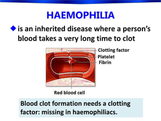 HAEMOPHILIA
is an inherited disease where a person’s
blood takes a very long time to clot
Blood clot formation needs a clotting
factor: missing in haemophiliacs.
 