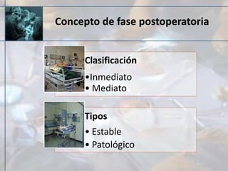 Concepto de fase postoperatoria
Clasificación
•Inmediato
• Mediato
Tipos
• Estable
• Patológico
 