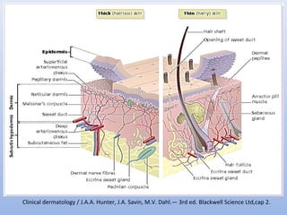 Clinical dermatology / J.A.A. Hunter, J.A. Savin, M.V. Dahl.— 3rd ed. Blackwell Science Ltd,cap 2.
 