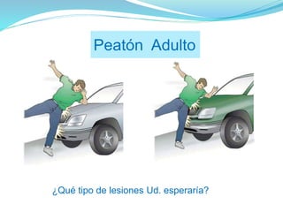 Peatón Adulto
¿Qué tipo de lesiones Ud. esperaría?
 