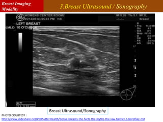 3.Breast Ultrasound / Sonography
PHOTO COURTESY :
http://www.slideshare.net/PCRSutterHealth/dense-breasts-the-facts-the-myths-the-law-harriet-b-borofsky-md
Breast Ultrasound/Sonography
Breast Imaging
Modality
 