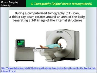 4. Tomography (Digital Breast Tomosynthesis)
Breast Imaging
Modality
http://www.slideshare.net/PCRSutterHealth/dense-breasts-the-facts-the-myths-the-law-harriet-
b-borofsky-md
 