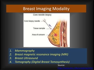 Breast Imaging Modality
1. Mammography
2. Breast magnetic resonance imaging (MRI)
3. Breast Ultrasound
4. Tomography (Digital Breast Tomosynthesis)
Source:
http://www.dcis.info/screening.html
 