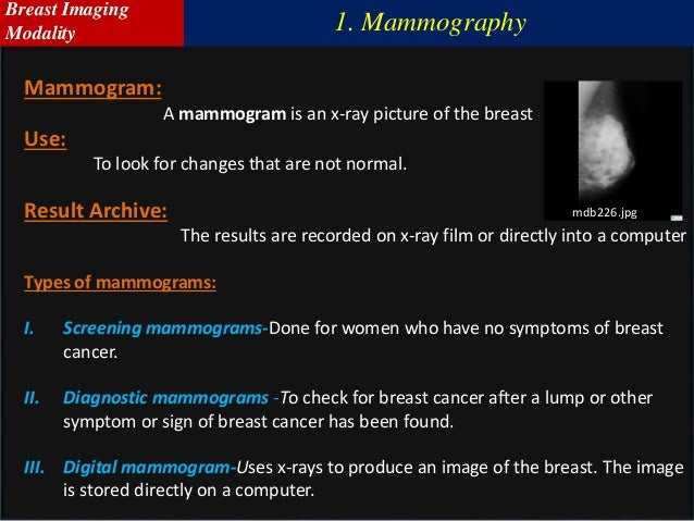 combined optical and x-ray tomosynthesis breast imaging 12 invision sally jobe breast centers and radiology imaging associates, denver, colorado 13 john c lincoln breast health and research center, objective to determine if mammography combined with tomosynthesis is associated with better performance of breast screening programs in the united states. combined optical and x-ray tomosynthesis breast imaging 12 invision sally jobe breast centers and radiology imaging associates, denver, colorado 13 john c lincoln breast health and research center, objective to determine if mammography combined with tomosynthesis is associated with better performance of breast screening programs in the united states.
