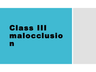 Class III
malocclusio
n
 