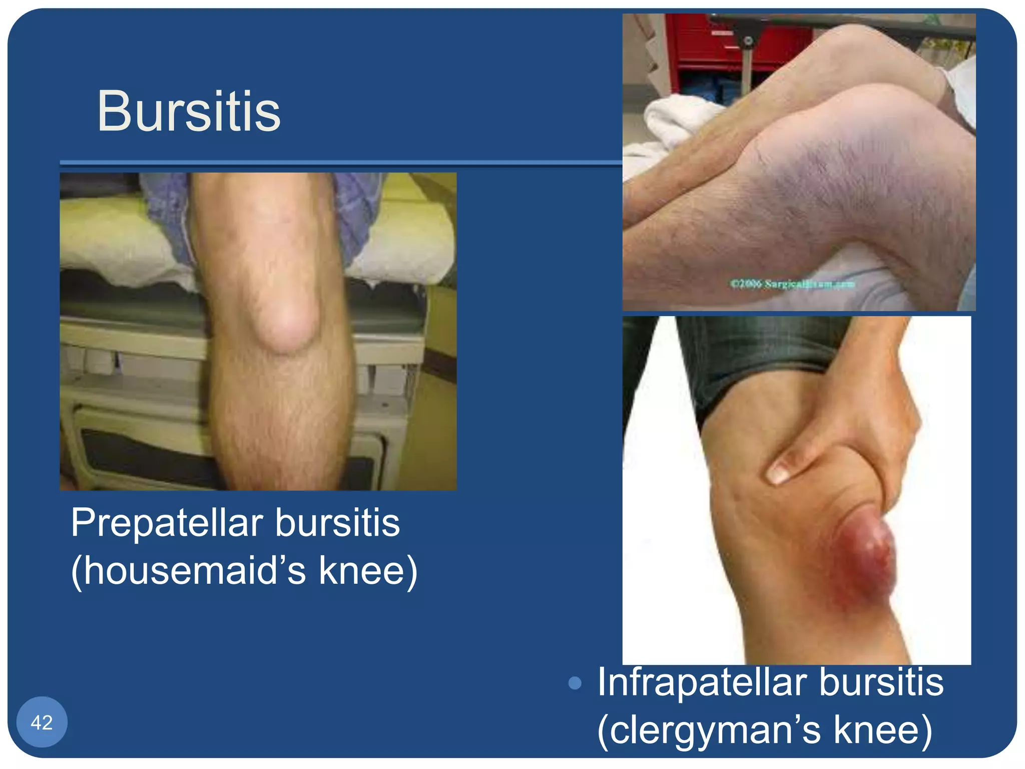 1 Biomechanics Of The Knee Joint Basics PPTX 1-biomechanics-of-the-knee-joint-basics-pptx