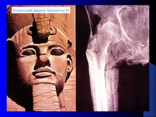 121
Египетский фараон Аменхотеп II
 