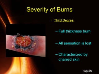 Powerpoint Templates
Page 20
• Third Degree:
– Full thickness burn
– All sensation is lost
– Characterized by
charred skin
Severity of BurnsSeverity of Burns
 