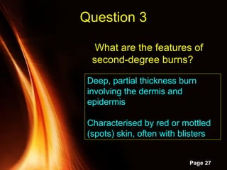 Powerpoint Templates
Page 27
What are the features of
second-degree burns?
Question 3
Deep, partial thickness burn
involving the dermis and
epidermis
Characterised by red or mottled
(spots) skin, often with blisters
 