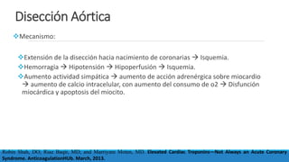 Disección Aórtica
Mecanismo:
Extensión de la disección hacia nacimiento de coronarias  Isquemia.
Hemorragia  Hipotensión  Hipoperfusión  Isquemia.
Aumento actividad simpática  aumento de acción adrenérgica sobre miocardio
 aumento de calcio intracelular, con aumento del consumo de o2  Disfunción
miocárdica y apoptosis del miocito.
Robin Shah, DO; Riaz Baqir, MD; and Marriyam Moten, MD. Elevated Cardiac Troponins—Not Always an Acute Coronary
Syndrome. AnticoagulationHUb. March, 2013.
 