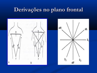 Derivações no plano frontalDerivações no plano frontal
 