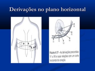 Derivações no plano horizontalDerivações no plano horizontal
 