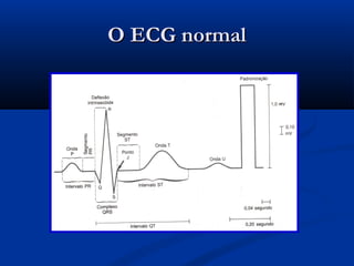 O ECG normalO ECG normal
 