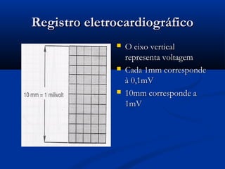Registro eletrocardiográficoRegistro eletrocardiográfico
 O eixo verticalO eixo vertical
representa voltagemrepresenta voltagem
 Cada 1mm correspondeCada 1mm corresponde
à 0,1mVà 0,1mV
 10mm corresponde a10mm corresponde a
1mV1mV
 