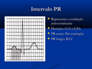 Intervalo PRIntervalo PR
 Representa a conduçãoRepresenta a condução
atrioventricularatrioventricular
 Duração: 0,12 a 0,20sDuração: 0,12 a 0,20s
 PR curto: Pré-excitaçãoPR curto: Pré-excitação
 PR longo: BAVPR longo: BAV
 