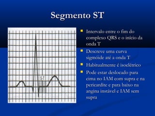 Segmento STSegmento ST
 Intervalo entre o fim doIntervalo entre o fim do
complexo QRS e o início dacomplexo QRS e o início da
onda Tonda T
 Descreve uma curvaDescreve uma curva
sigmóide até a onda Tsigmóide até a onda T
 Habitualmente é isoelétricoHabitualmente é isoelétrico
 Pode estar deslocado paraPode estar deslocado para
cima no IAM com supra e nacima no IAM com supra e na
pericardite e para baixo napericardite e para baixo na
angina instável e IAM semangina instável e IAM sem
suprasupra
 