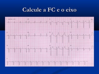 Calcule a FC e o eixoCalcule a FC e o eixo
 