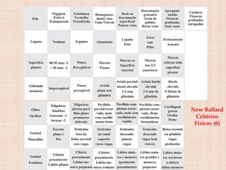 New Ballard
Critérios
Físicos (6)
 