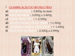  CLASSIFICAÇÃO DO RN PELO PESO
a) MACROSSOMIA: 3.800g ou mais
b) PESO NORMAL: 3.000g a 3.800g
c) BAIXO PESO (BP): < 2.500g
d) MUITO BAIXO PESO (MBP): <1.500g
e) EXTREMO BAIXO PESO (EBP): < 1.000g
f) PESO INSUFICIENTE: 2.500g a 2.999g
 
