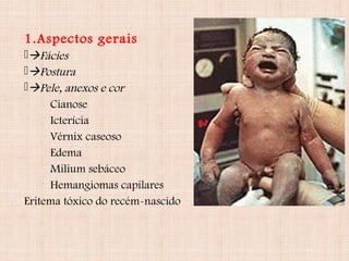 1.Aspectos gerais
Fácies
Postura
Pele, anexos e cor
Cianose
Icterícia
Vérnix caseoso
Edema
Milium sebáceo
Hemangiomas capilares
Eritema tóxico do recém-nascido
 