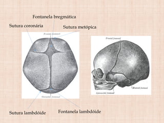 Fontanela bregmática
Sutura coronária Sutura metópica
Sutura lambdóide Fontanela lambdóide
 