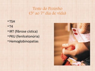 Teste do Pezinho
(5º ao 7º dia de vida)
•TSH
•T4
•IRT (fibrose cística)
•PKU (fenilcetonúria)
•Hemoglobinopatias
 