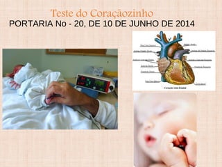 Teste do Coraçãozinho
PORTARIA No - 20, DE 10 DE JUNHO DE 2014
 