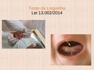 Teste da Linguinha
Lei 13.002/2014
 
