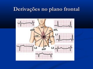 Derivações no plano frontalDerivações no plano frontal
 
