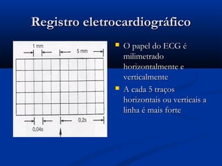 Registro eletrocardiográficoRegistro eletrocardiográfico
 O papel do ECG éO papel do ECG é
milimetradomilimetrado
horizontalmente ehorizontalmente e
verticalmenteverticalmente
 A cada 5 traçosA cada 5 traços
horizontais ou verticais ahorizontais ou verticais a
linha é mais fortelinha é mais forte
 