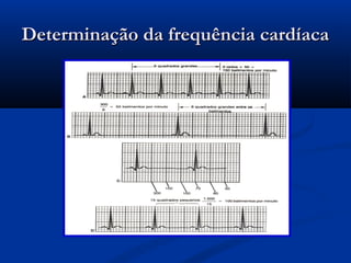 Determinação da frequência cardíacaDeterminação da frequência cardíaca
 