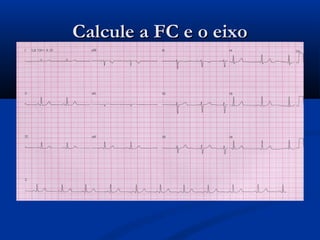 Calcule a FC e o eixoCalcule a FC e o eixo
 