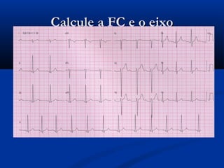 Calcule a FC e o eixoCalcule a FC e o eixo
 