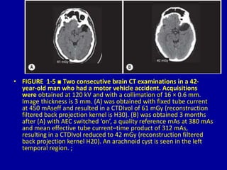 Ct Brain Collimation 1 Medical Physics Radiation Risk Garringer and Aliison Dr. Muhammad Bin ...
